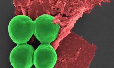 ازبین رفتن اَبَر میکروب‌ها با نانوفناوری